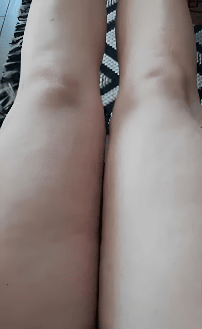 Après — Marie (43 ans)