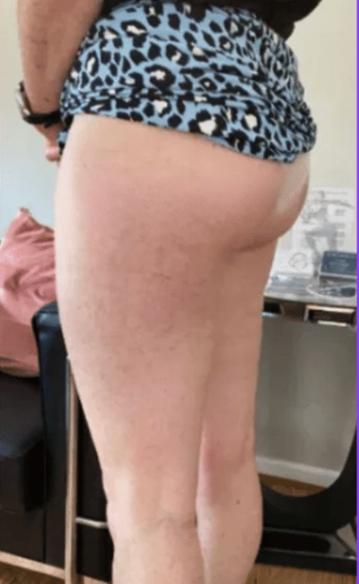 Après — Laura (31 ans)