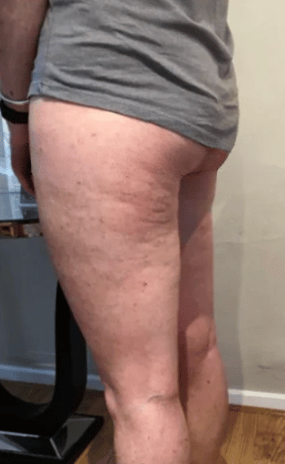 Avant — Laura (31 ans)