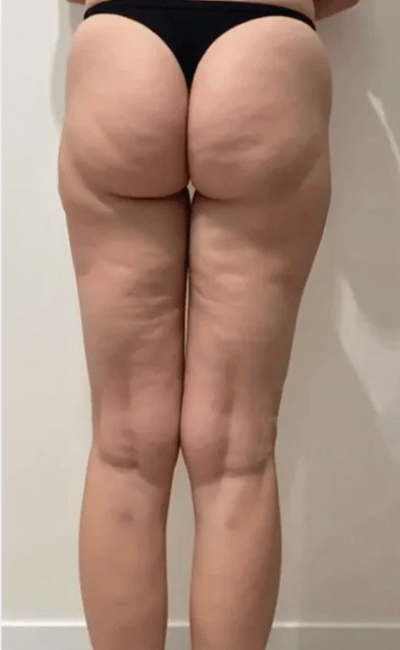Avant — Sophie (38 ans)