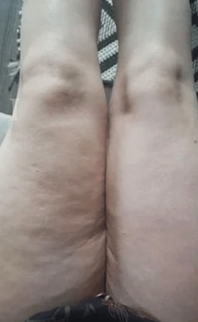 Avant — Marie (43 ans)