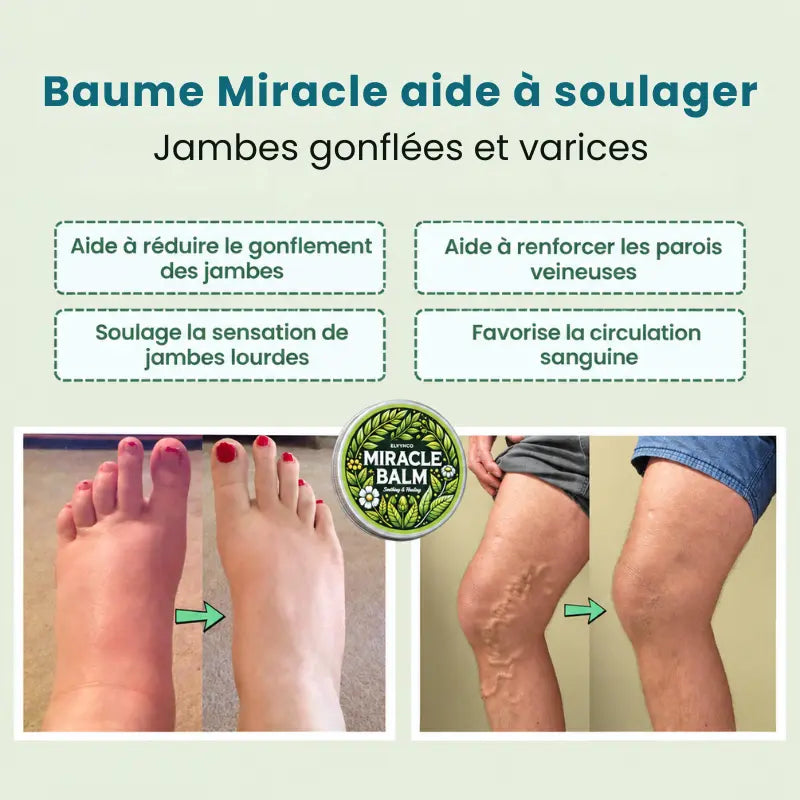Application du baume sur le dessus du pied