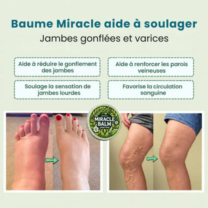 Application du baume sur le dessus du pied